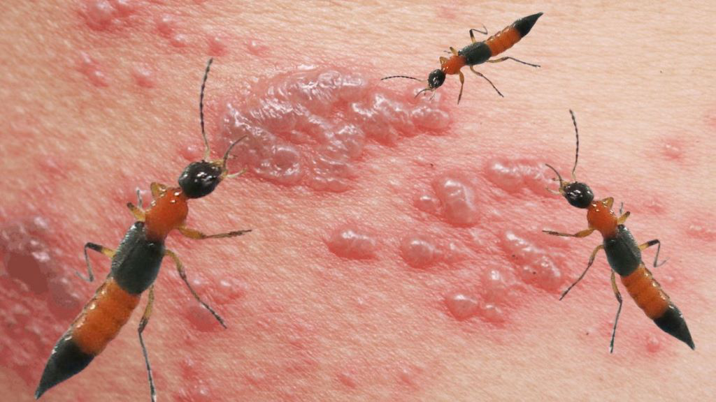 Kiến Ba Khoang - Cách phòng tránh kiến ba khoang hiệu quả